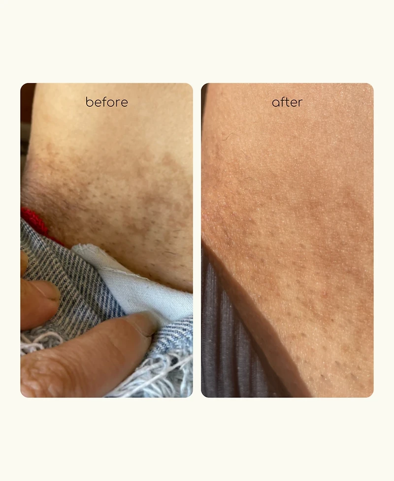 Forgotten Skincare The Down Low Inner Thigh Serum