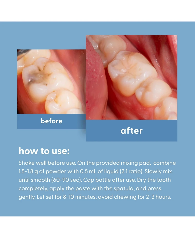 M3 Dental Tooth Repair Kit with Temporary Filling Material and Travel Case