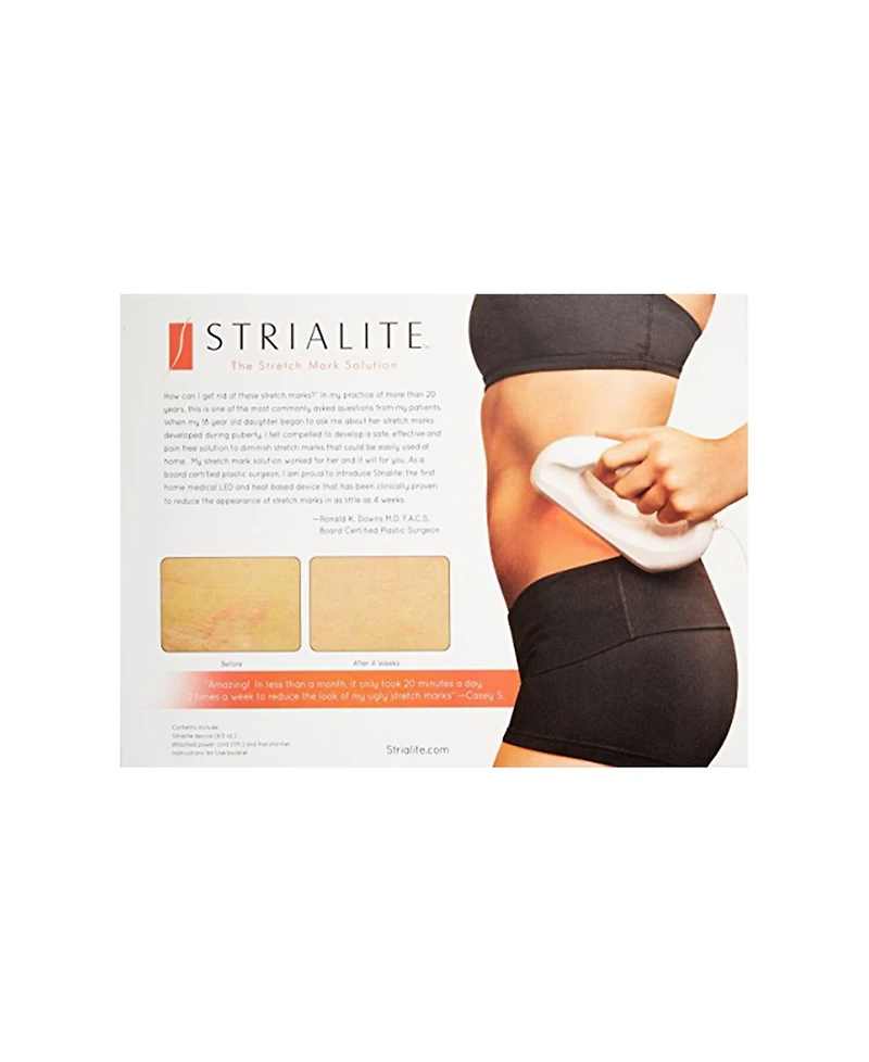 Strialite Stretchmark Device