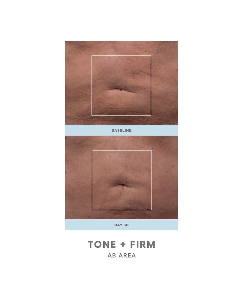 NuFACE 2-Pc. NuBODY Skin Toning Device Set