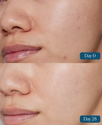 Elemis Dynamic Resurfacing Super-c Serum, 1 oz.