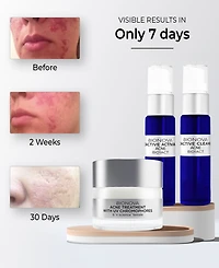 Bionova Acne Discovery Collection With Uv Chromophores