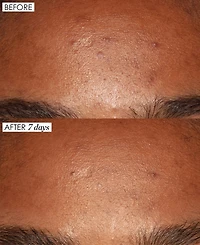 Sunday Riley Good Genes All-In-One Lactic Acid Treatment