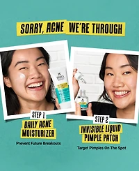 Kiehl's Since 1851 Expertly Clear Acne-Treating & Preventing Lotion