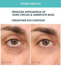 Foreo Iris C-Concentrated Eye Cream, 15 ml