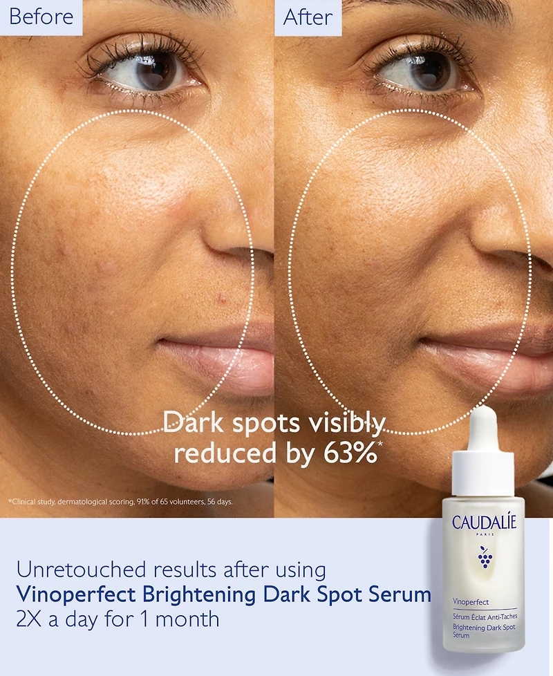 Caudalie Vinoperfect Brightening Dark Spot Serum Jumbo, 1.6 oz.