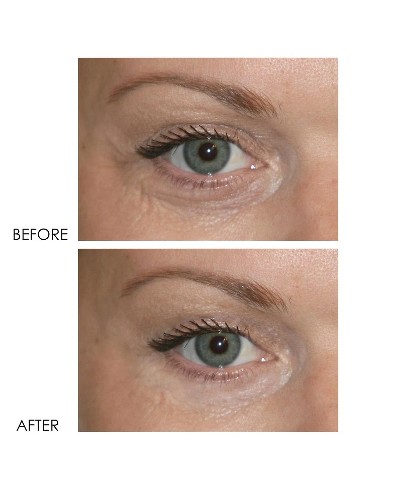 Dermelect Revitalite Professional Eyelid & Dark Circle Corrector