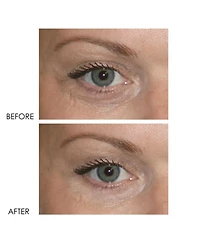 Dermelect Revitalite Professional Eyelid & Dark Circle Corrector