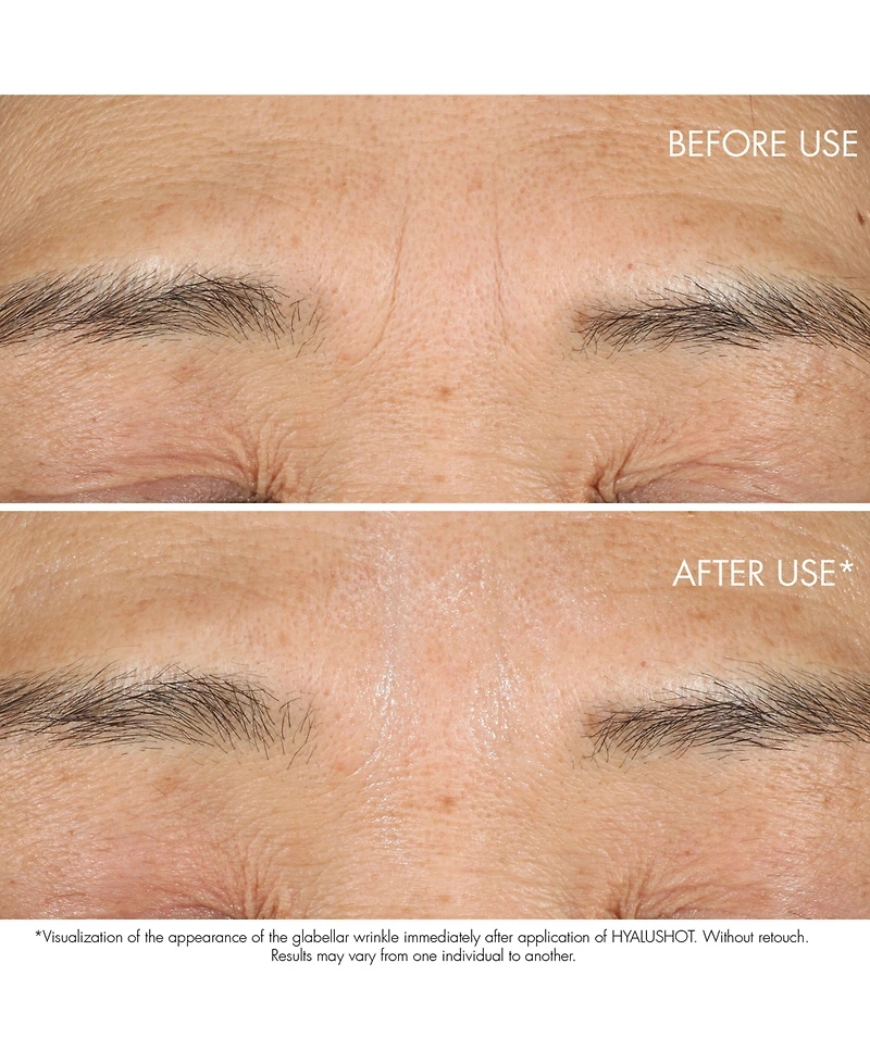 Capture Totale Hyalushot Wrinkle Corrector with Hyaluronic Acid