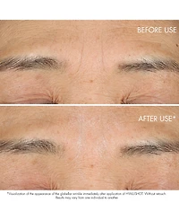 Capture Totale Hyalushot Wrinkle Corrector with Hyaluronic Acid