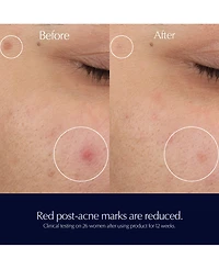Estee Lauder Advanced Night Repair Rescue Solution Serum with 15% Bifidus Ferment, 0.68 oz.
