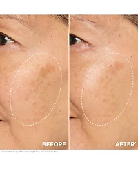 Bright Plus Brightening Vitamin C & Niacinamide Dark Spot Serum, 1 oz.