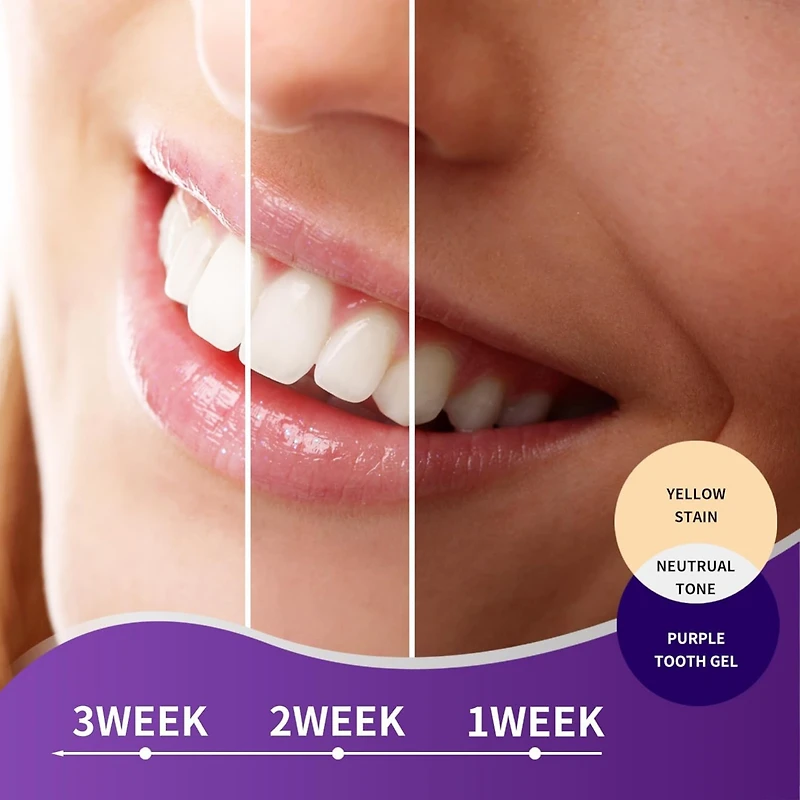 Essential Sonic Toothbrush + Purple Toothpaste Bundle