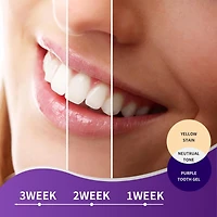 Essential Sonic Toothbrush + Purple Toothpaste Bundle