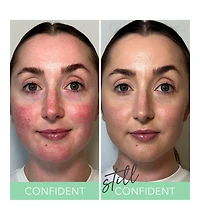 T.c.e. Color Correcting Green Cream