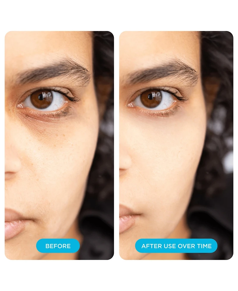 Night Depuffing Hyaluronic Acid Undereye Patches 48-Pack