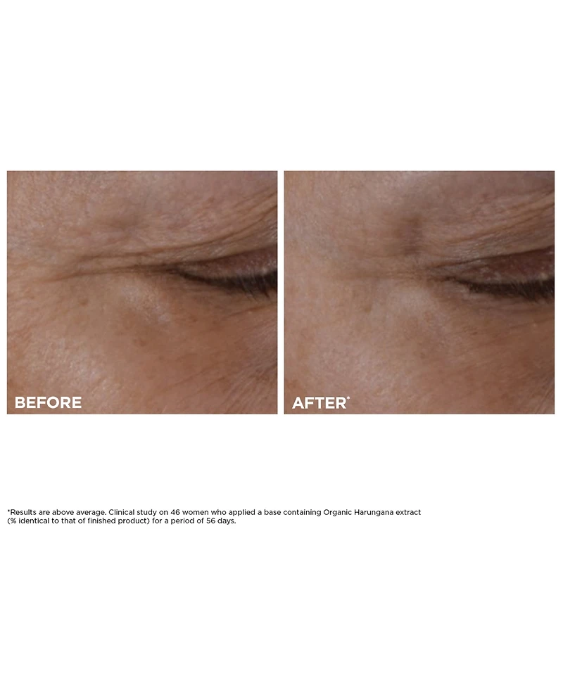 Clarins 3-Pc. Total Eye Lift Set