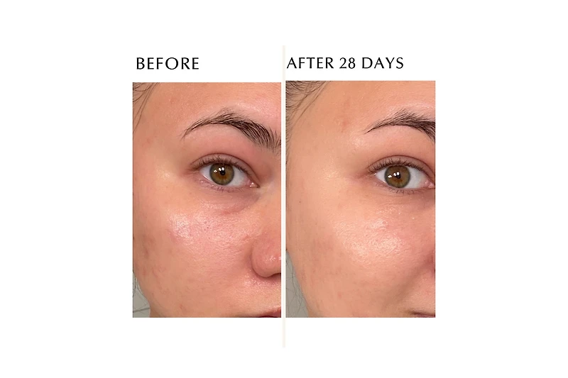 Albion Excia Brightening Immaculate Serum Z