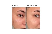 Albion Excia Brightening Immaculate Serum Z