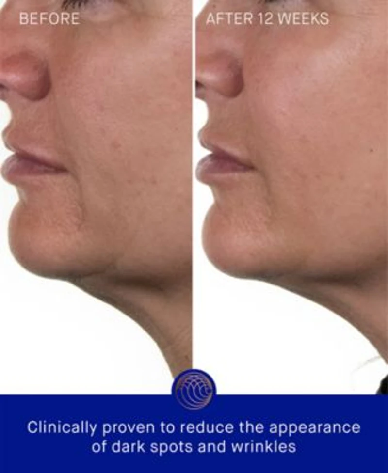 Augustinus Bader The Rich Cream