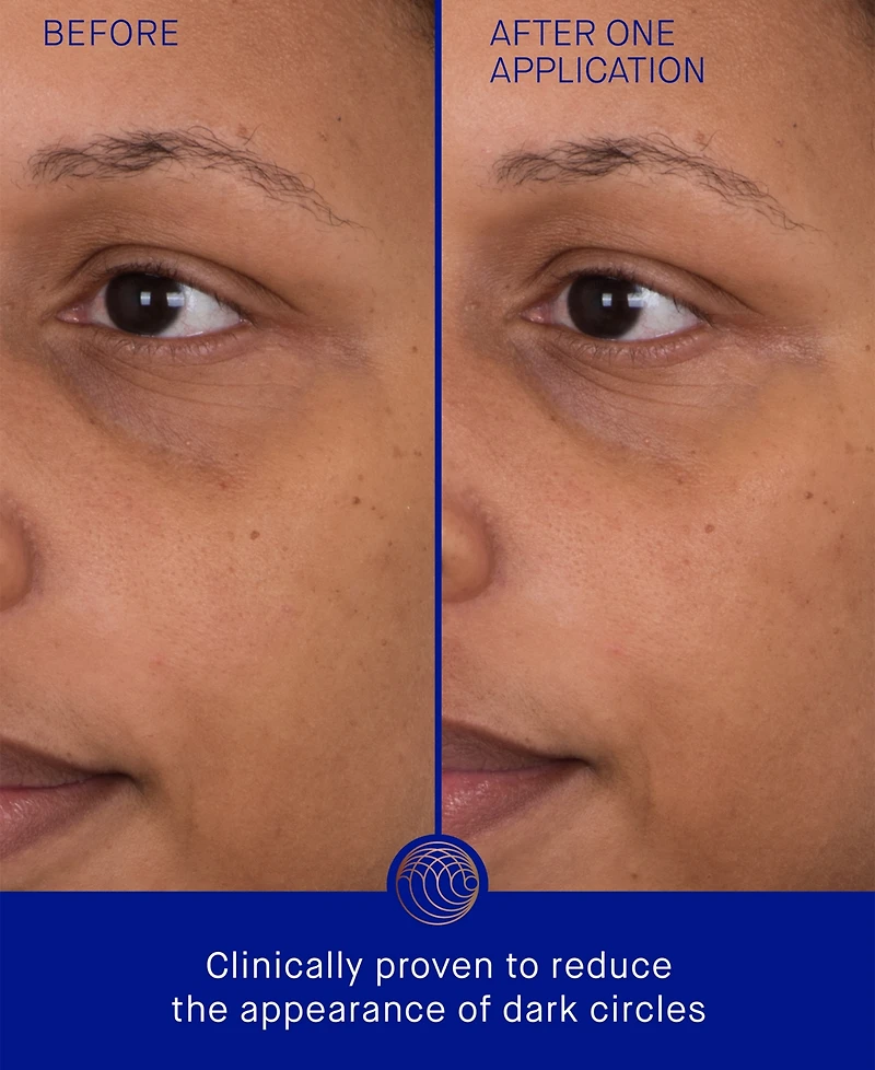 Augustinus Bader The Eye Patch Bundle, 3-Pack