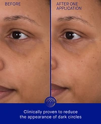 Augustinus Bader The Eye Patch Bundle, 3-Pack