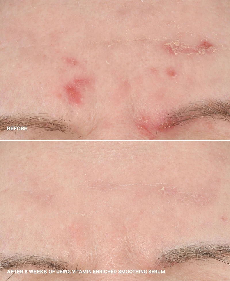 Bobbi Brown Vitamin Enriched Smoothing Niacinamide + Vitamin C Serum, 1 oz.