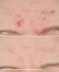 Bobbi Brown Vitamin Enriched Smoothing Niacinamide + Vitamin C Serum, 1 oz.