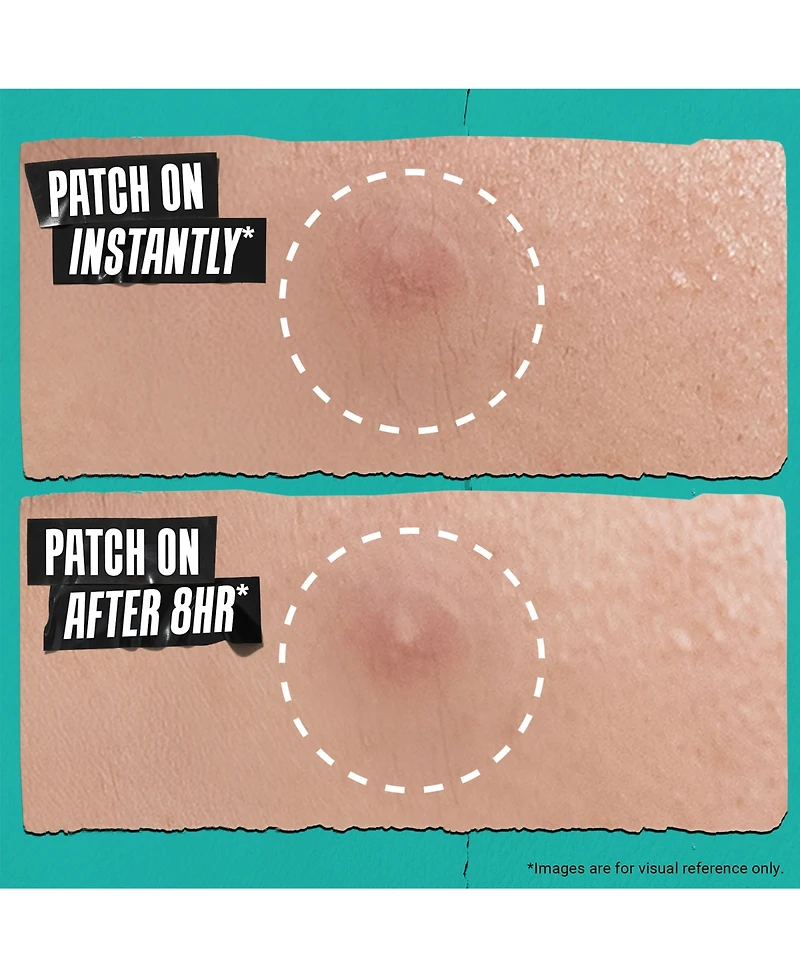 Kiehl's Since 1851 22-Pc. Acne Physical Patch Set