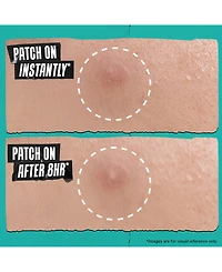 Kiehl's Since 1851 22-Pc. Acne Physical Patch Set