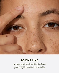 Origins Super Spot Remover Acne Treatment Gel With Salicylic Acid, 0.3 oz.