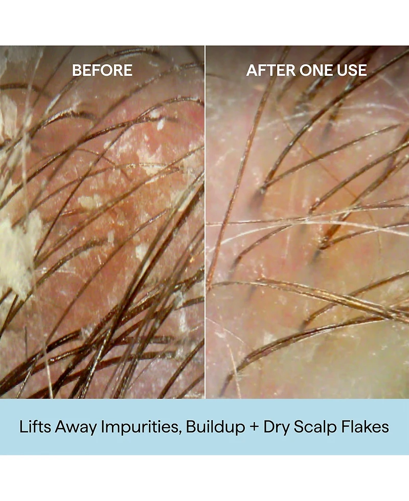 Briogeo Scalp Revival Charcoal + Coconut Oil Micro-Exfoliating Shampoo Jumbo, 32 oz.