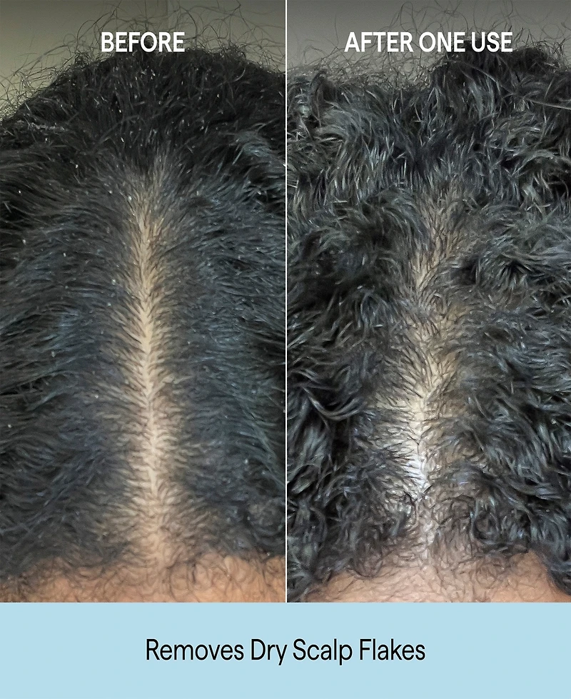 Briogeo Scalp Revival Charcoal + Coconut Oil Micro-Exfoliating Shampoo, 2 oz.