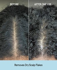 Briogeo Scalp Revival Charcoal + Coconut Oil Micro-Exfoliating Shampoo, 2 oz.
