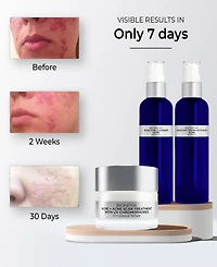 Bionova Acne + Acne Scar Treatment with Uv Chromophores