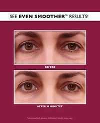 Peter Thomas Roth Even Smoother Glycolic Retinol Hydra-Gel Eye Patches, 30 patches