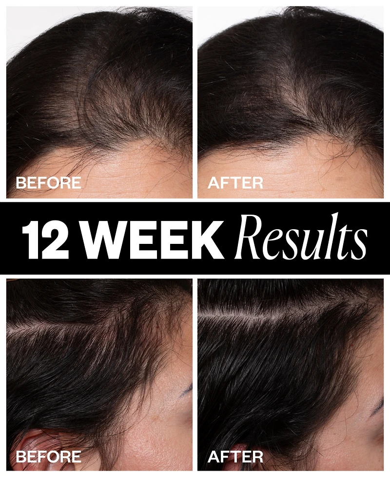 Igk Hair Sponsored Hair Density Scalp Treatment, 2.1 oz.