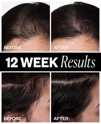 Igk Hair Sponsored Hair Density Scalp Treatment, 2.1 oz.