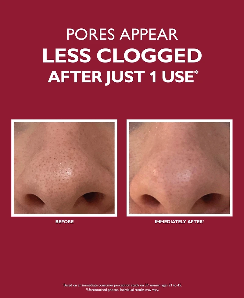 Peter Thomas Roth Even Smoother Microdermabrasion Exfoliating Pore Purifier, 1.7 oz.