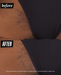 Kiehl's Since 1851 Ingrown Hair & Tone-Correcting Intimate Drops