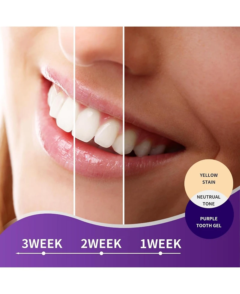 MySmile Purple Toothpaste for Tooth Brighten, Color Corrector Efficient Cleaning Toothpaste, 30ML Non-Sensitive Natural Tooth Stain Removal Toothpaste