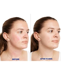 Korres Greek Yoghurt Probiotic SuperDose Face Mask, 3.38 oz.