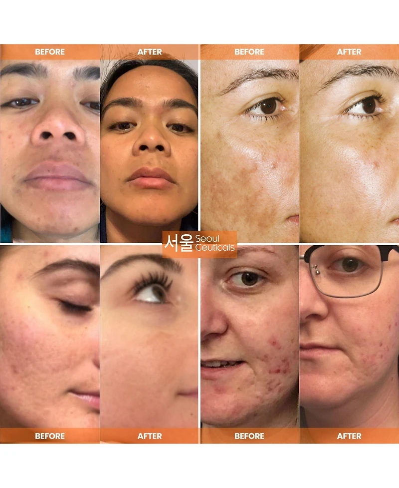 Korean Skin Care Vitamin C Serum Day Glow Serum