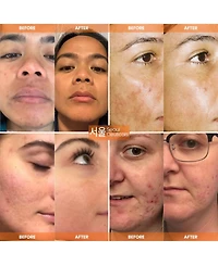 Korean Skin Care Vitamin C Serum Day Glow Serum