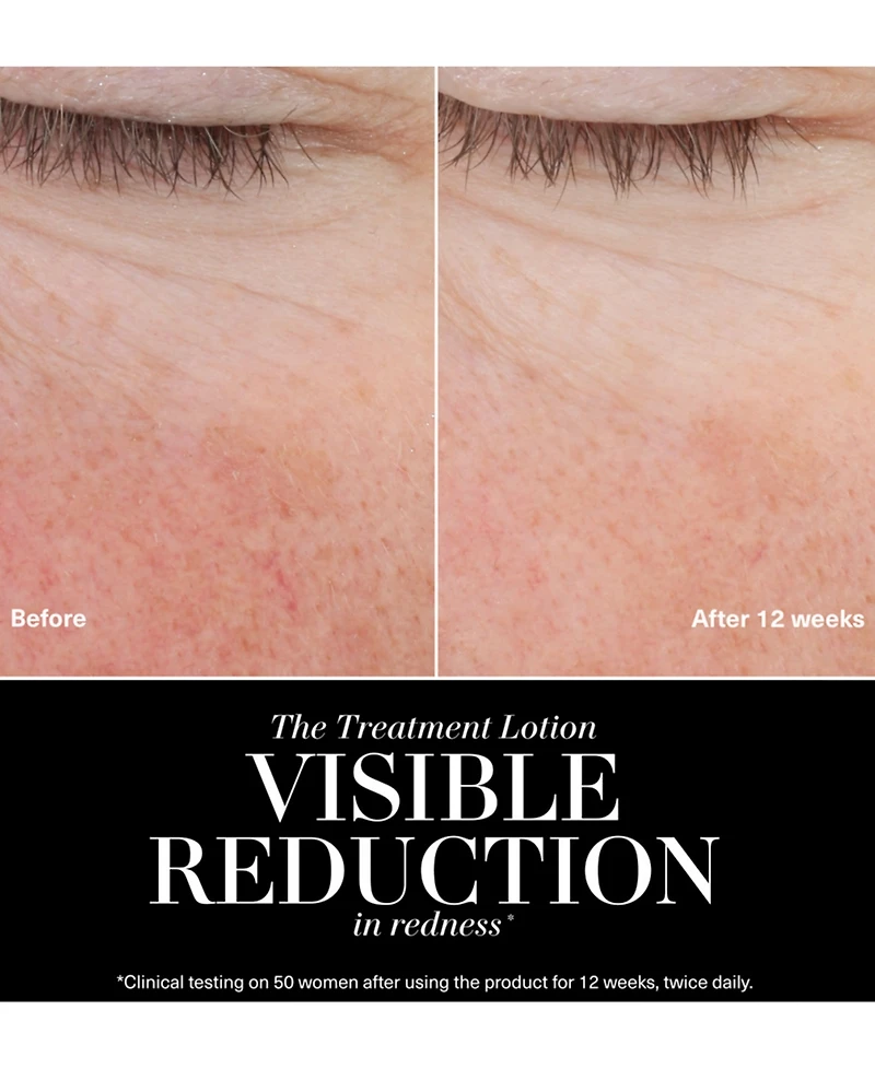 La Mer The Treatment Jumbo Lotion, 3.39 oz.