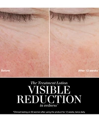 La Mer The Treatment Jumbo Lotion, 3.39 oz.