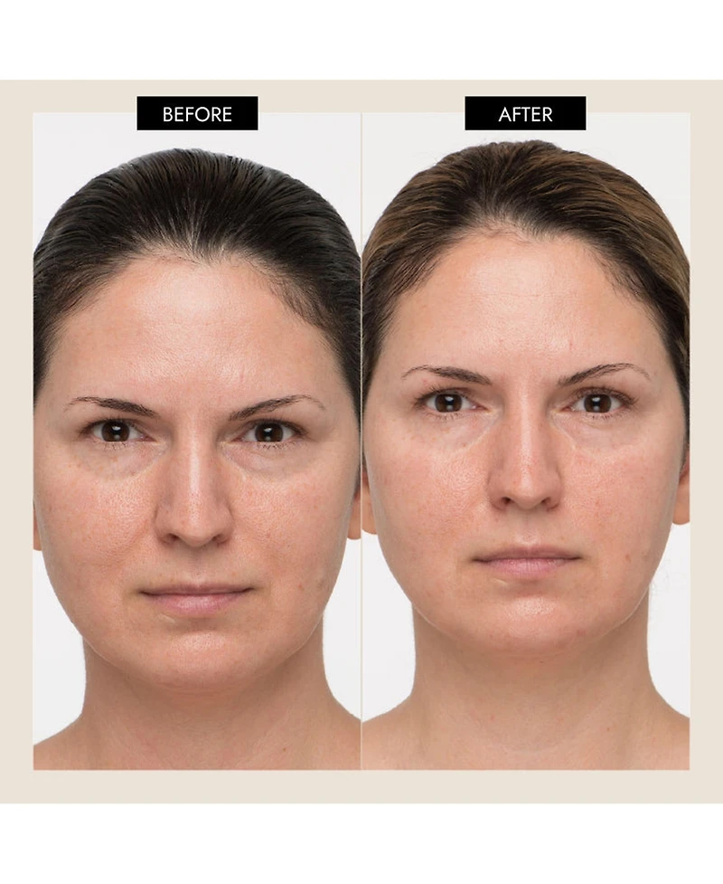 7E Wellness MyoLift Mini Home Care Starter Kit