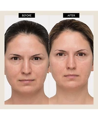 7E Wellness MyoLift Mini Home Care Starter Kit