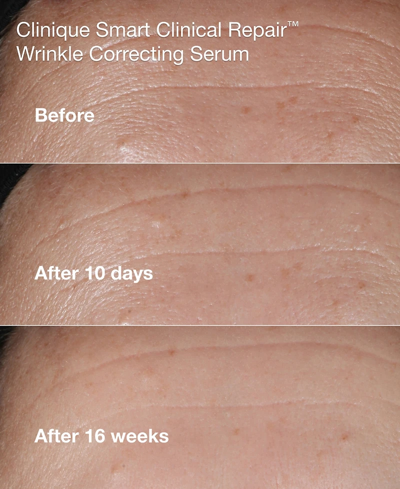 Clinique 3-Pc. Mini Smart Clinical Repair Skincare Set