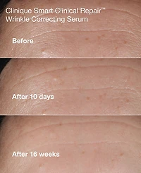 Clinique 3-Pc. Mini Smart Clinical Repair Skincare Set